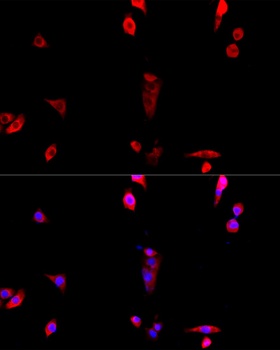 BAZ1B Antibody, KO Validated