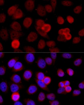 BAZ1B Antibody, KO Validated