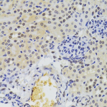 SUZ12 Antibody