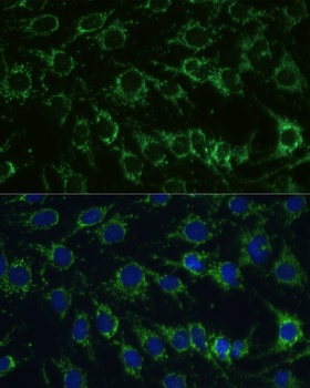 YBX1 Antibody, KO Validated