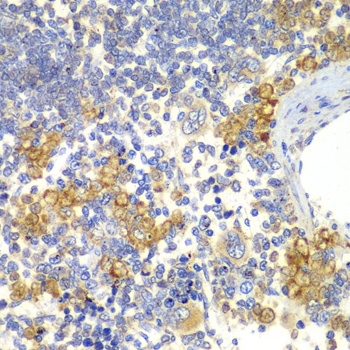 NOTCH1 Antibody
