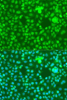 NOTCH1 Antibody