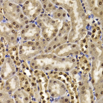 LC3B Antibody, KO Validated
