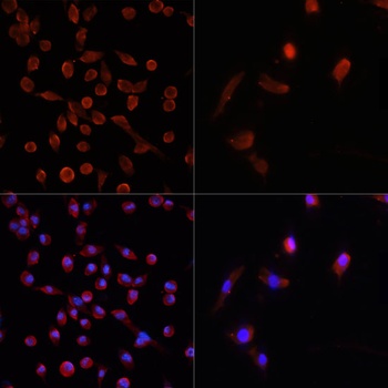 LC3B Antibody, KO Validated