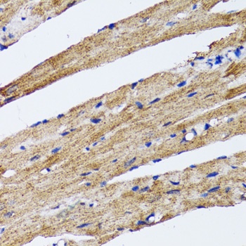 LC3B Antibody, KO Validated
