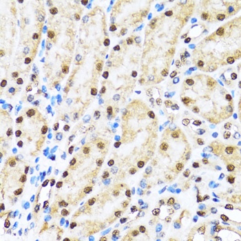 LC3B Antibody, KO Validated