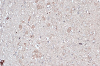 LC3B Antibody, KO Validated