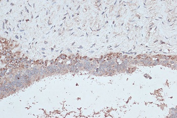 LC3B Antibody, KO Validated