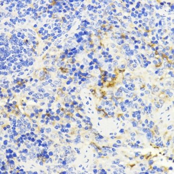 NFKB1 Antibody