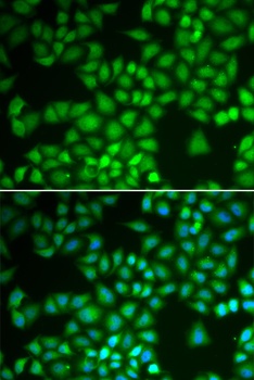 NFKB1 Antibody