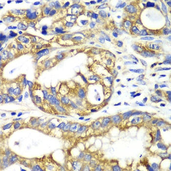 AK2 Antibody