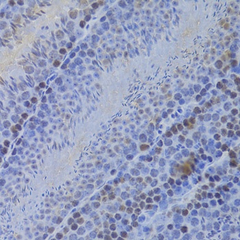 HELLS Antibody