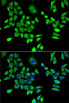 HPRT1 Antibody