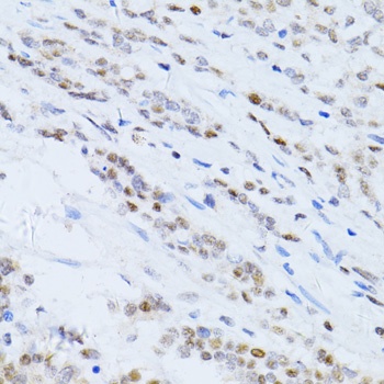 CDKN1A Antibody