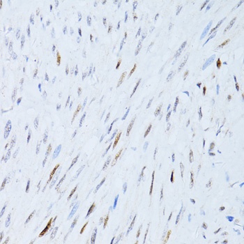 CDKN1A Antibody