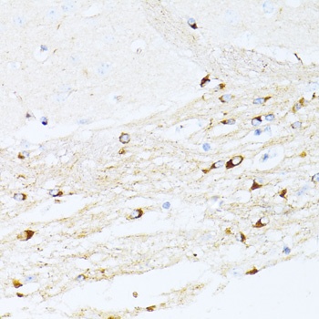 CDKN1A Antibody