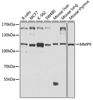 MMP9 Antibody