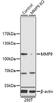 MMP9 Antibody