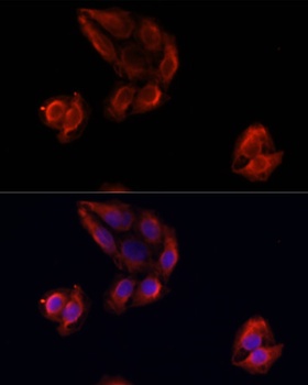 MMP9 Antibody