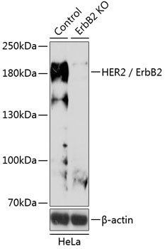 ErbB2 Antibody
