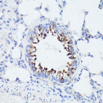 ErbB2 Antibody
