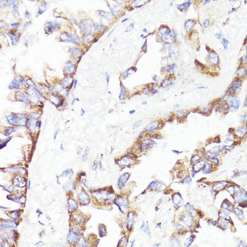 ErbB2 Antibody