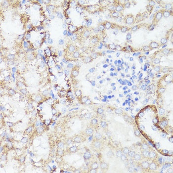 ErbB2 Antibody