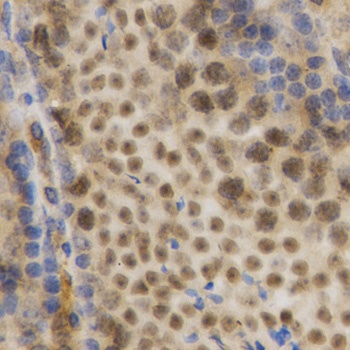 HuR / ELAVL1 Antibody, KO Validated
