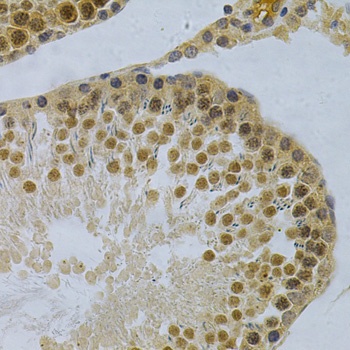 HuR / ELAVL1 Antibody, KO Validated