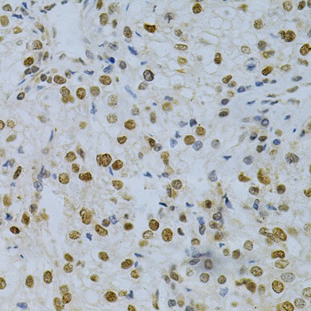 HuR / ELAVL1 Antibody, KO Validated