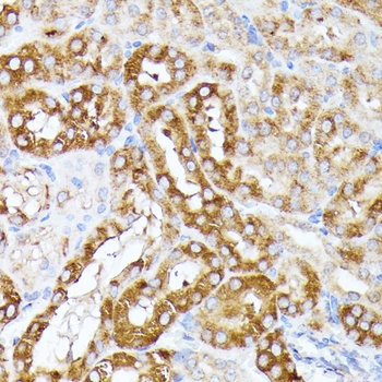 HuR / ELAVL1 Antibody, KO Validated