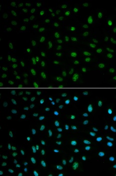 HuR / ELAVL1 Antibody, KO Validated