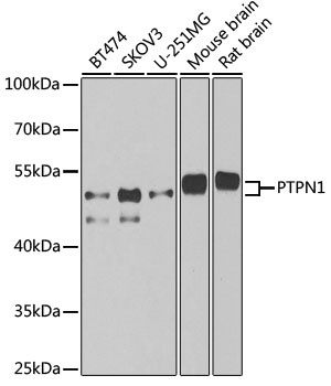 PTPN1 Antibody
