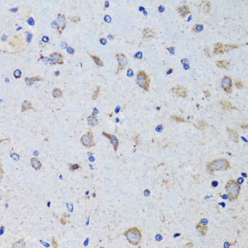 PTPN1 Antibody