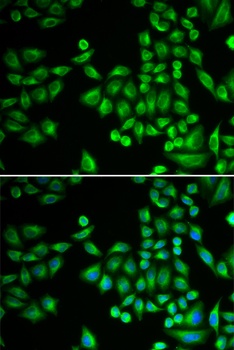 PTPN1 Antibody