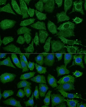 NDUFB4 Antibody