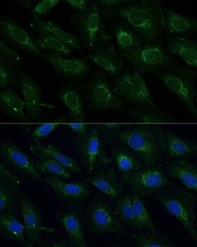 NDUFB4 Antibody
