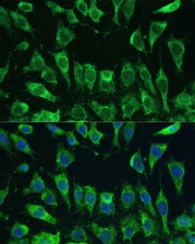 LGALS3 Antibody