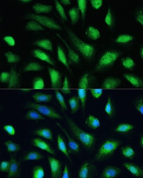LGALS3 Antibody