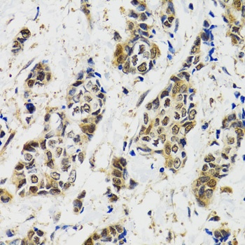 MAPK9 Antibody
