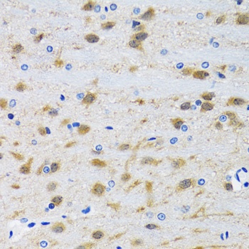 MAPK9 Antibody