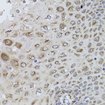 PRKAB1 Antibody