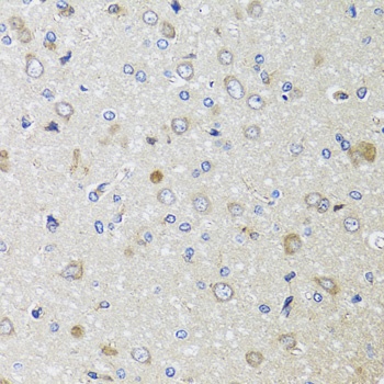 B2M Antibody