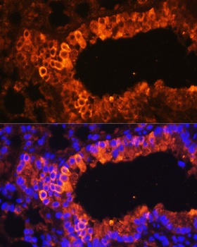BAX Antibody, KO Validated