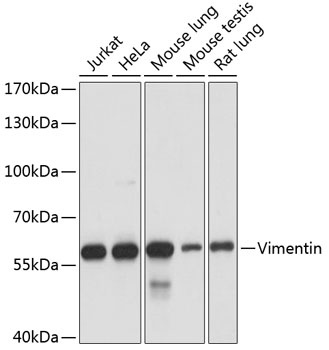 VIM Antibody