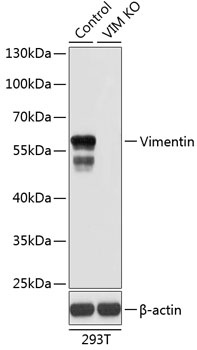 VIM Antibody