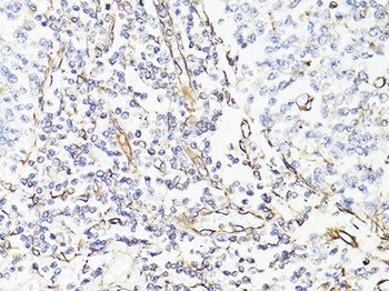 VIM Antibody