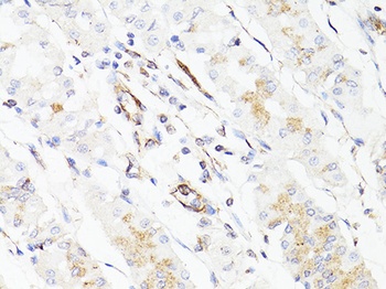 VIM Antibody