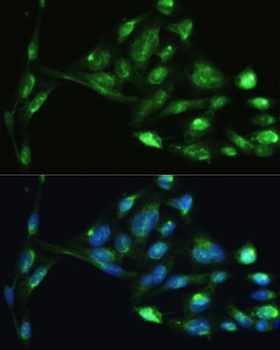 VIM Antibody