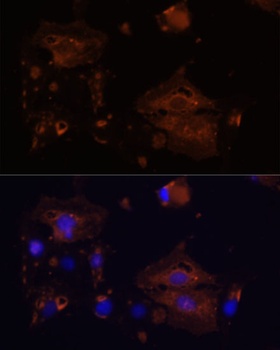 BAX Antibody, KO Validated